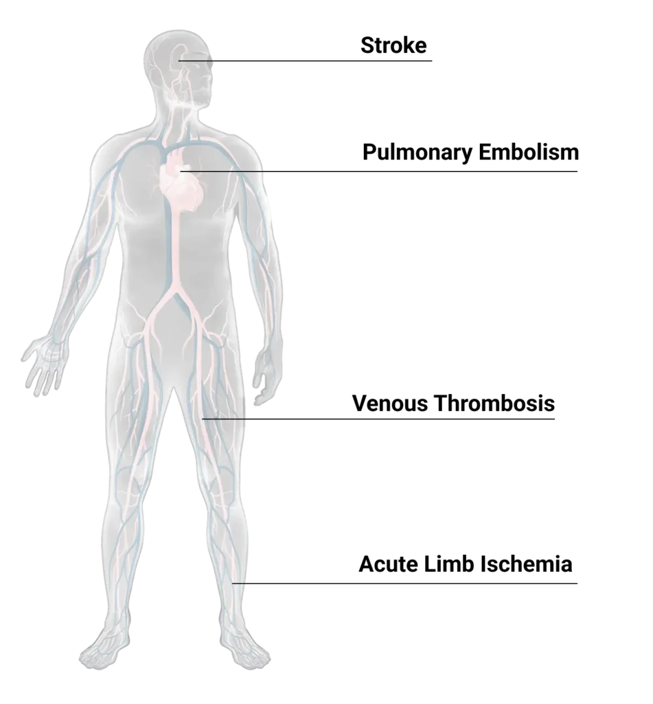 Body chart with labels